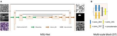 MSU-Net: Multi-Scale U-Net for 2D Medical Image Segmentation